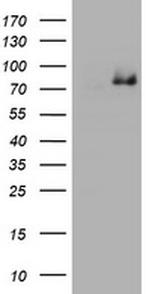 NBN Antibody in Western Blot (WB)