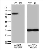 NBN Antibody in Western Blot (WB)