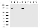 NBN Antibody in Western Blot (WB)