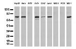 NBN Antibody in Western Blot (WB)