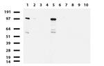 NBN Antibody in Western Blot (WB)