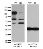 NBN Antibody in Western Blot (WB)