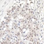 NCBP1/CBP80 Antibody in Immunohistochemistry (IHC)