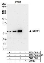 NCBP1/CBP80 Antibody in Western Blot (WB)