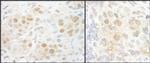 NCBP2 Antibody in Immunohistochemistry (IHC)