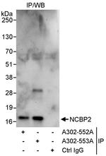 NCBP2 Antibody in Immunoprecipitation (IP)