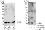 NCBP2 Antibody in Western Blot (WB)