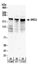 NCOA2/SRC2 Antibody in Western Blot (WB)