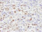 NCOA2/SRC2 Antibody in Immunohistochemistry (IHC)