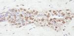 NCOA2/SRC2 Antibody in Immunohistochemistry (IHC)