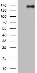 NCOA2 Antibody in Western Blot (WB)