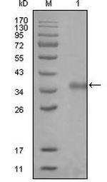 NCoR1 Antibody in Western Blot (WB)