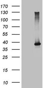 NCR2 Antibody in Western Blot (WB)