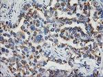 NDEL1 Antibody in Immunohistochemistry (Paraffin) (IHC (P))