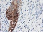 NDEL1 Antibody in Immunohistochemistry (Paraffin) (IHC (P))