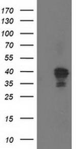 NDEL1 Antibody in Western Blot (WB)