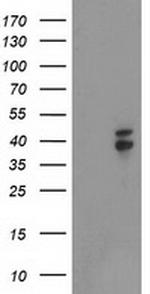 NDEL1 Antibody in Western Blot (WB)