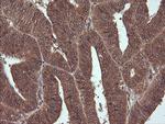 NDOR1 Antibody in Immunohistochemistry (Paraffin) (IHC (P))