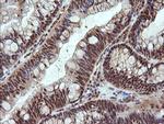 NDOR1 Antibody in Immunohistochemistry (Paraffin) (IHC (P))