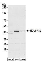 NDUFA10 Antibody in Western Blot (WB)