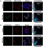 NDUFA13 Antibody in Immunocytochemistry (ICC/IF)