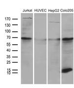 NDUFA4L2 Antibody in Western Blot (WB)