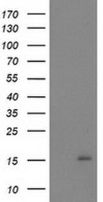 NDUFA7 Antibody in Western Blot (WB)