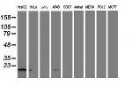 NDUFA7 Antibody in Western Blot (WB)