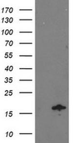 NDUFA7 Antibody in Western Blot (WB)