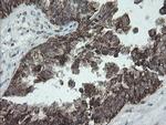 NDUFB10 Antibody in Immunohistochemistry (Paraffin) (IHC (P))