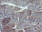 NDUFB10 Antibody in Immunohistochemistry (Paraffin) (IHC (P))