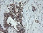 NDUFB10 Antibody in Immunohistochemistry (Paraffin) (IHC (P))