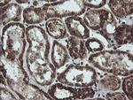 NDUFB10 Antibody in Immunohistochemistry (Paraffin) (IHC (P))