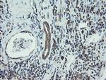 NDUFB10 Antibody in Immunohistochemistry (Paraffin) (IHC (P))