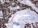 NDUFB10 Antibody in Immunohistochemistry (Paraffin) (IHC (P))