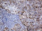 NDUFB10 Antibody in Immunohistochemistry (Paraffin) (IHC (P))