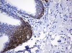 NDUFB10 Antibody in Immunohistochemistry (Paraffin) (IHC (P))