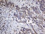 NDUFB10 Antibody in Immunohistochemistry (Paraffin) (IHC (P))