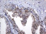 NDUFB10 Antibody in Immunohistochemistry (Paraffin) (IHC (P))