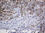 NDUFB10 Antibody in Immunohistochemistry (Paraffin) (IHC (P))