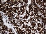 NDUFB10 Antibody in Immunohistochemistry (Paraffin) (IHC (P))