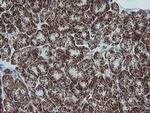 NDUFB10 Antibody in Immunohistochemistry (Paraffin) (IHC (P))