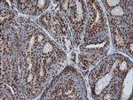 NDUFB10 Antibody in Immunohistochemistry (Paraffin) (IHC (P))