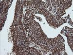 NDUFB10 Antibody in Immunohistochemistry (Paraffin) (IHC (P))