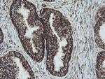 NDUFB10 Antibody in Immunohistochemistry (Paraffin) (IHC (P))