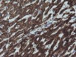 NDUFB10 Antibody in Immunohistochemistry (Paraffin) (IHC (P))