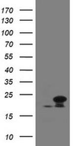 NDUFB10 Antibody in Western Blot (WB)