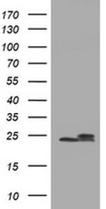 NDUFB10 Antibody in Western Blot (WB)