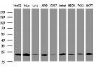 NDUFB10 Antibody in Western Blot (WB)