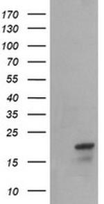 NDUFB10 Antibody in Western Blot (WB)